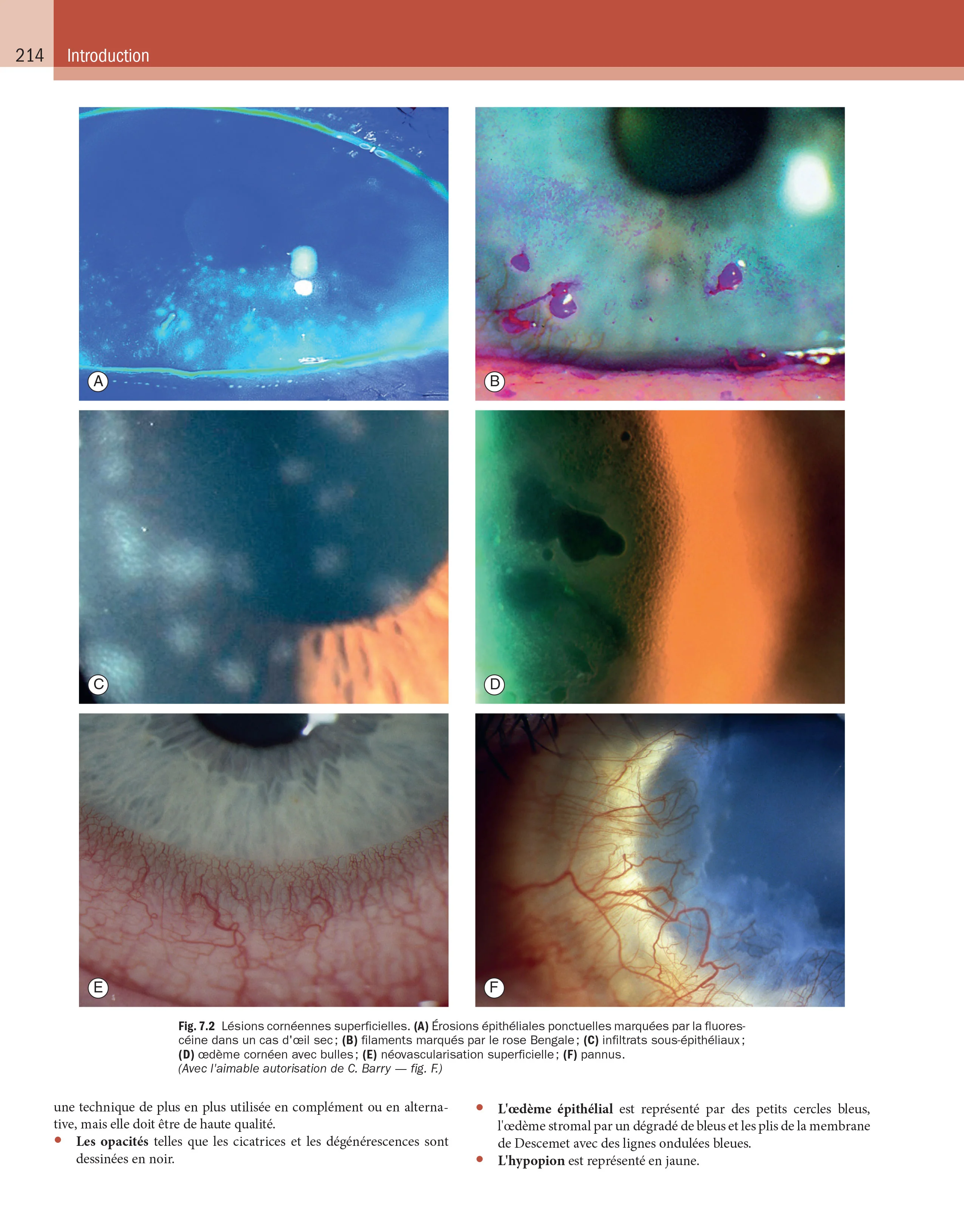 Kanski - Ophtalmologie clinique - Image 6