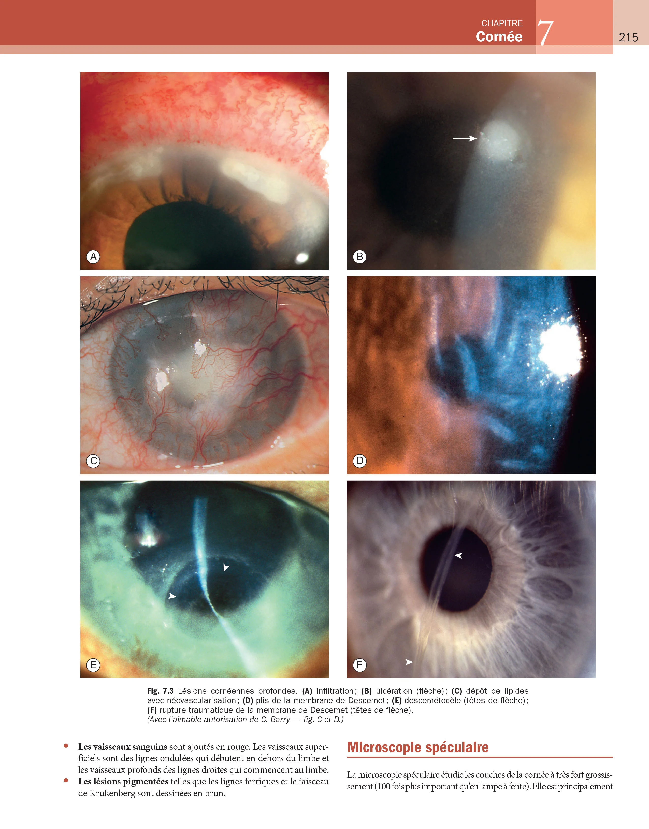 Kanski - Ophtalmologie clinique - Image 7