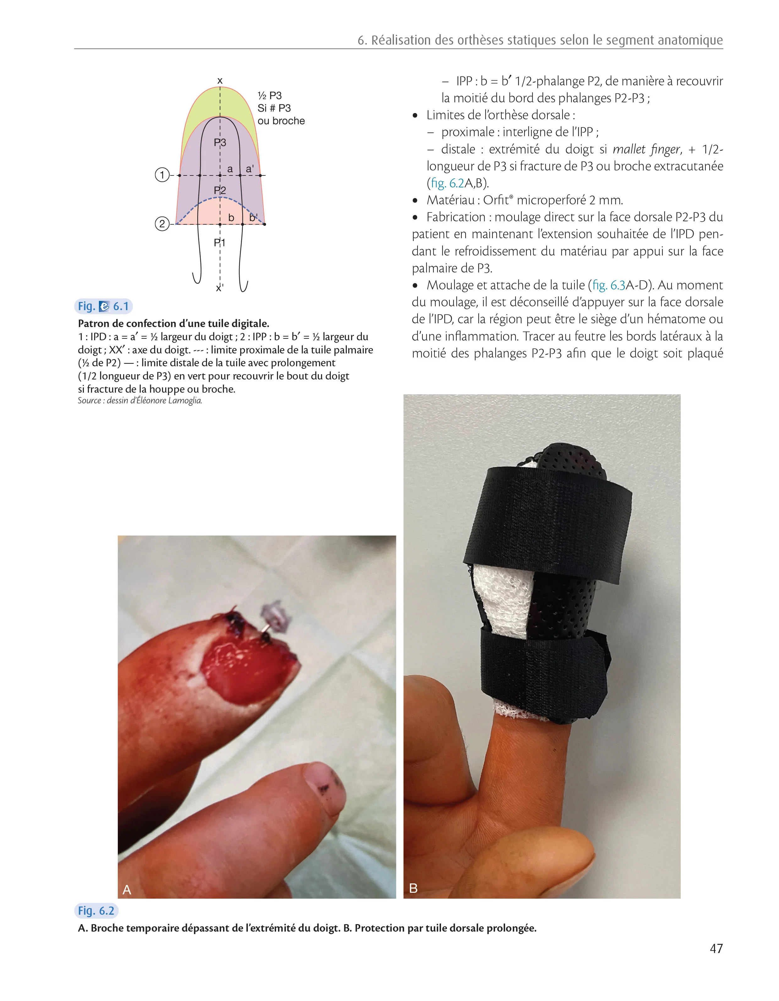 Orthèses de la main et du poignet - Image 11