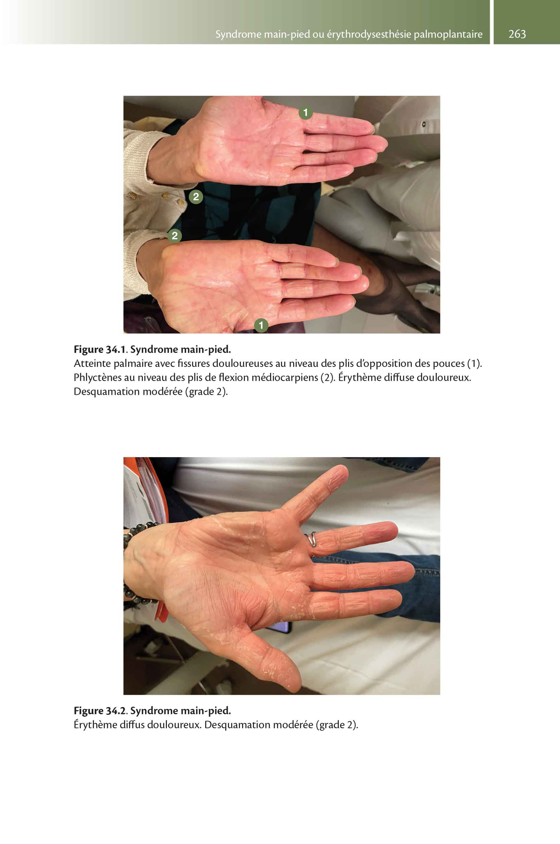 Tout-en-un d'oncologie - Image 5