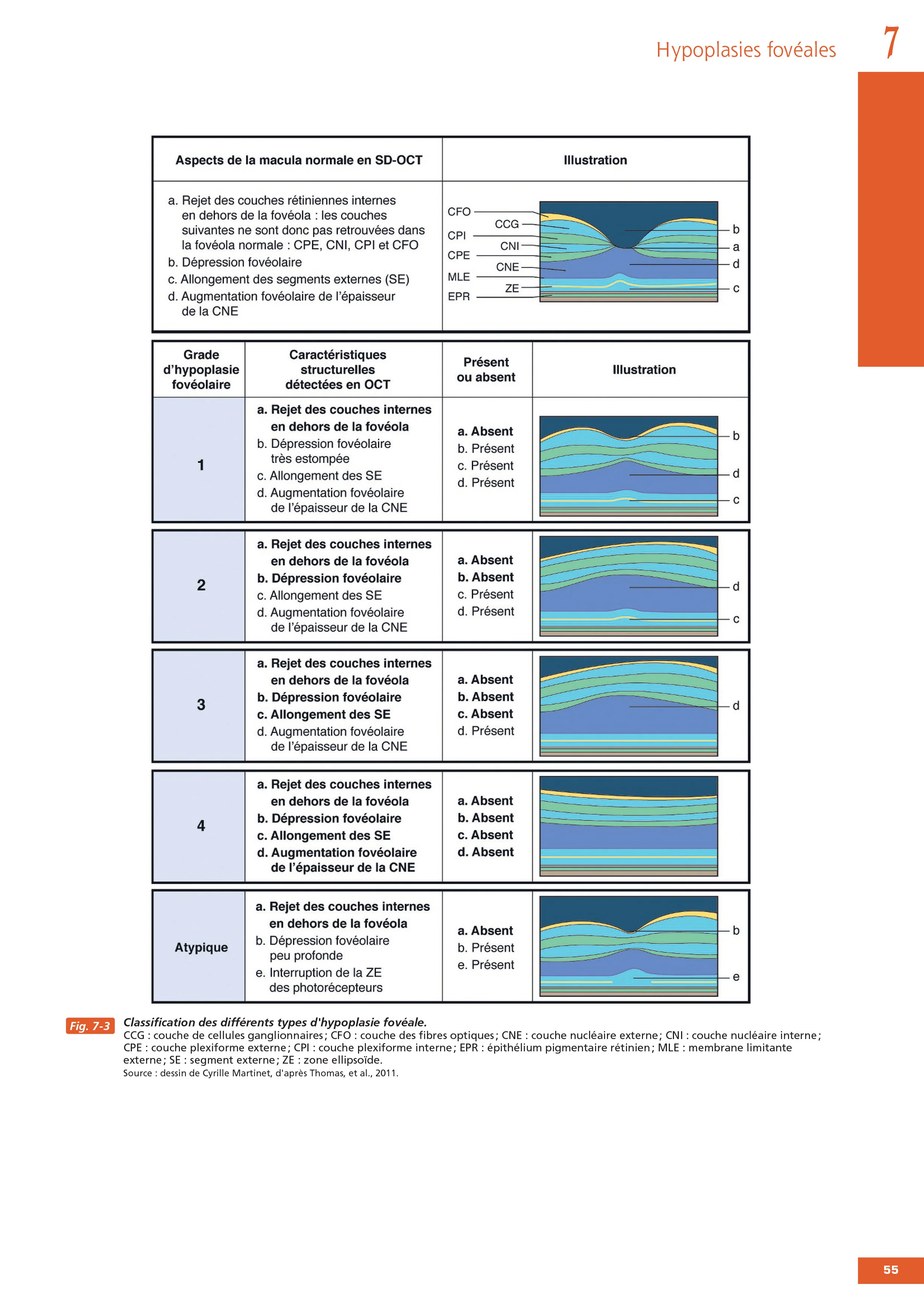 Des gènes aux traitements en ophtalmologie. Rapport SFO 2026 - Image 5