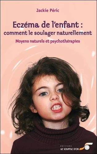 Eczéma de l'enfant : Comment le soulager naturellement - Image 2