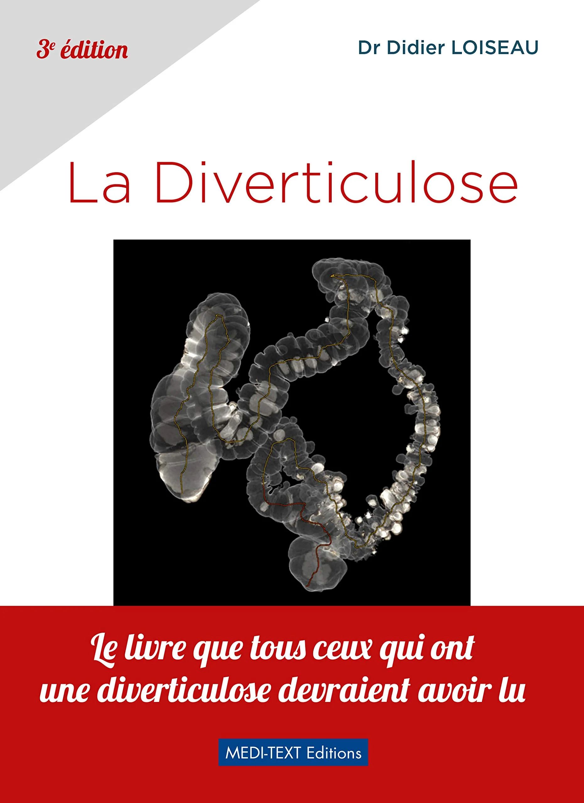 La Diverticulose - 3ème éditio - Image 2